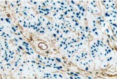 Immunohistochemistry: VECTASTAIN(R) ABC anti-mouse/rabbit AP Immunodetection Kit [AK-5200-NB]