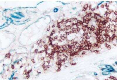 Immunohistochemistry: VECTASTAIN(R) ABC anti-mouse/rabbit AP Immunodetection Kit [AK-5200-NB]