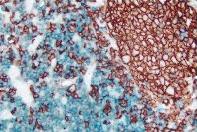 Immunohistochemistry: VECTASTAIN(R) ABC anti-mouse/rabbit AP Immunodetection Kit [AK-5200-NB]