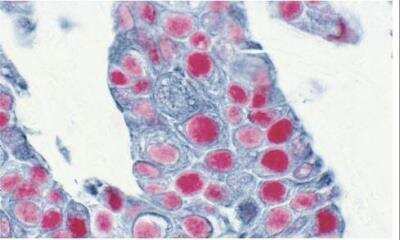 Immunohistochemistry: VECTASTAIN(R) ABC anti-mouse/rabbit AP Immunodetection Kit [AK-5200-NB]
