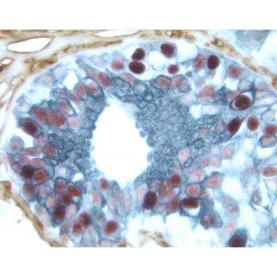 Immunohistochemistry-Paraffin: VECTASTAIN(R) ELITE(R) ABC HRP Detection Kit [PK-6100-NB]
