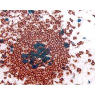 Immunohistochemistry: VECTASTAIN(R) ELITE(R) ABC anti-mouse/rabbit HRP Immunodetection Kit [PK-6200-NB]