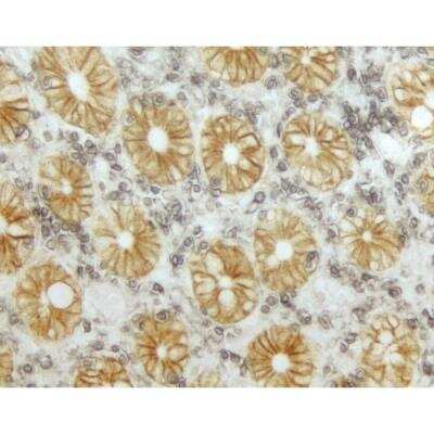 Immunohistochemistry: VECTASTAIN(R) ELITE(R) ABC anti-mouse/rabbit HRP Immunodetection Kit [PK-6200-NB]