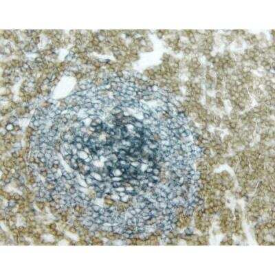Immunohistochemistry: VECTASTAIN(R) ELITE(R) ABC anti-mouse/rabbit HRP Immunodetection Kit [PK-6200-NB]