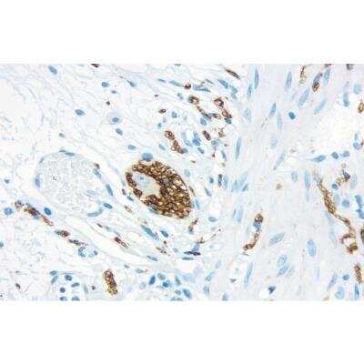 Immunohistochemistry: VECTASTAIN(R) ELITE(R) ABC anti-mouse/rabbit HRP Immunodetection Kit [PK-6200-NB]