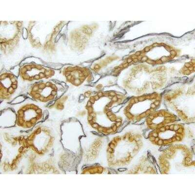 Immunohistochemistry: VECTASTAIN(R) ELITE(R) ABC anti-mouse/rabbit HRP Immunodetection Kit [PK-6200-NB]