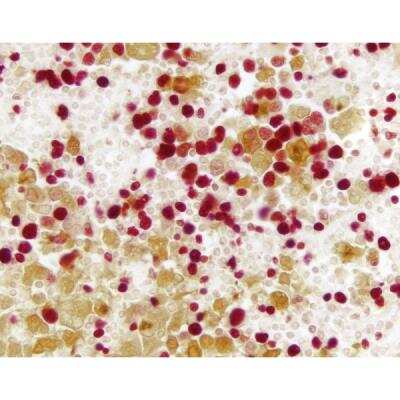 Immunohistochemistry: VECTASTAIN(R) ELITE(R) ABC anti-mouse/rabbit HRP Immunodetection Kit [PK-6200-NB]