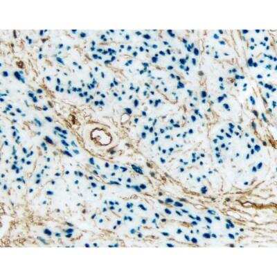 Immunohistochemistry: VECTASTAIN(R) ELITE(R) ABC anti-mouse/rabbit HRP Immunodetection Kit [PK-6200-NB]