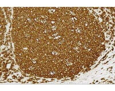 Immunohistochemistry-Paraffin: VECTASTAIN(R) Elite(R) ABC Universal PLUS anti-mouse/rabbit IgG HRP Immunodetection Kit [PK-8200-NB]