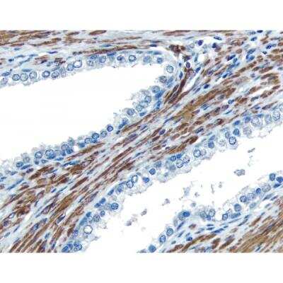 Immunohistochemistry: VECTASTAIN(R) Universal Quick anti-mouse/rabbit/goat IgG HRP Immunodetection Kit [PK-7800-NB]