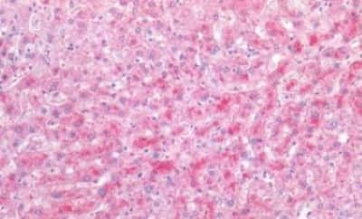 Immunohistochemistry-Paraffin: VEGF 165 Antibody [NBP3-14566]