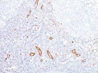 Immunohistochemistry-Paraffin: VEGF Antibody (VEGF/1063) [NBP2-45235]