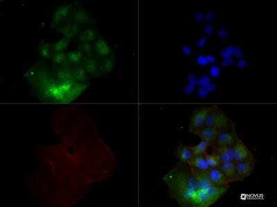 Immunocytochemistry/Immunofluorescence Staining of VEGF in MCF7 Cells