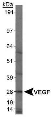 Western Blot Analysis of VEGF in Human Kidney