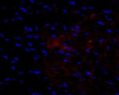 Immunocytochemistry/ Immunofluorescence: VEGF Antibody (VG76e) - BSA Free [NB100-648]