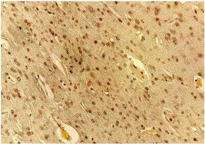 Immunohistochemistry-Paraffin: VEGF Antibody (VG76e) - BSA Free [NB100-648]