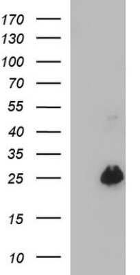 Western Blot: VEGF-B Antibody (OTI1H9)Azide and BSA Free [NBP2-74844]