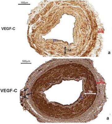 Immunohistochemistry: VEGF-C Antibody (107/F10) - Azide and BSA Free [NBP1-18626]