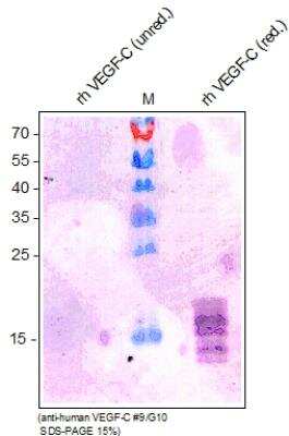 Western Blot: VEGF-C Antibody (9/G10)Azide and BSA Free [NBP2-36287]