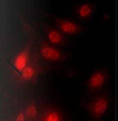 Immunocytochemistry/ Immunofluorescence: VEGF-C Antibody [NB110-61022]