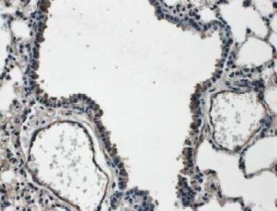 Immunohistochemistry: VEGF-C Antibody [NB110-61022]