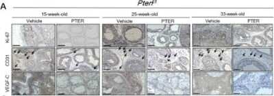 Immunohistochemistry-Paraffin: VEGF-C Antibody [NB110-61022]
