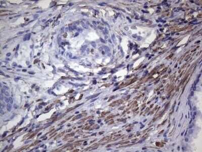 Immunohistochemistry: VEGF-C Antibody (OTI4A1) - Azide and BSA Free [NBP2-74845]