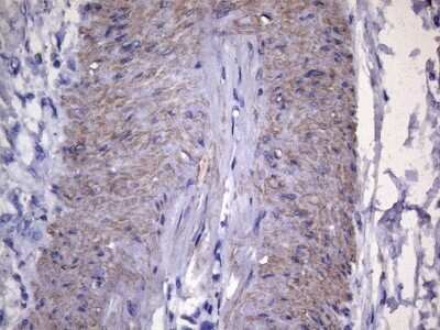 Immunohistochemistry-Paraffin: VEGF-C Antibody (OTI4A1) [NBP2-45404]