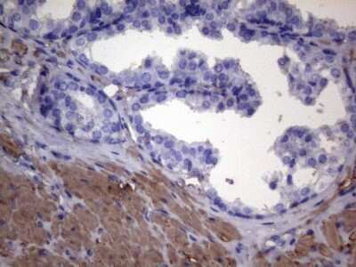 Immunohistochemistry-Paraffin: VEGF-C Antibody (OTI4A1) [NBP2-45404]