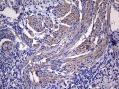 Immunohistochemistry-Paraffin: VEGF-C Antibody (OTI4A1) [NBP2-45404]