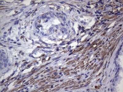 Immunohistochemistry-Paraffin: VEGF-C Antibody (OTI4A1) [NBP2-45404]