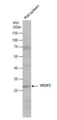 Western Blot: VEGF-C Antibody [NBP2-20853]