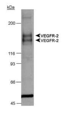 Western Blot: VEGFR1/Flt-1 Antibody [NB100-527]