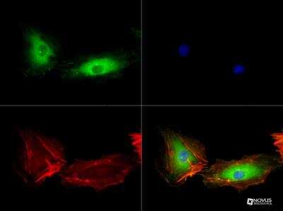 Immunocytochemistry/ Immunofluorescence: VEGFR2/KDR/Flk-1 Antibody (1B6) - BSA Free [NBP2-36428]