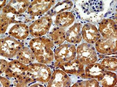 Immunohistochemistry-Paraffin: VEGFR2/KDR/Flk-1 Antibody (1B6) - BSA Free [NBP2-36428]