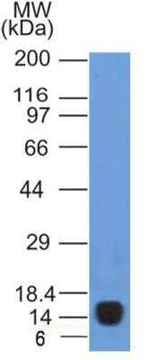 Western Blot: VEGFR2/KDR/Flk-1 Antibody (1B6)BSA Free [NBP2-36428]