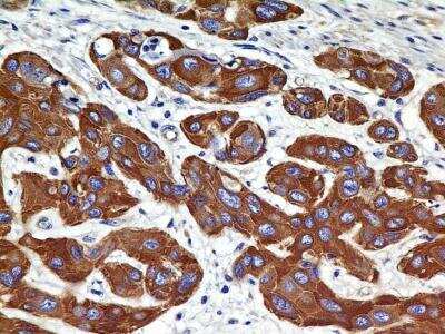 Immunohistochemistry-Paraffin: VEGFR2/KDR/Flk-1 Antibody (2C6) - BSA Free [NBP2-36429]