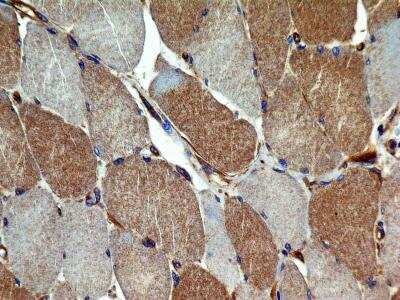 Immunohistochemistry-Paraffin: VEGFR2/KDR/Flk-1 Antibody (2C6) - BSA Free [NBP2-36429]