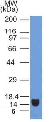 Western Blot: VEGFR2/KDR/Flk-1 Antibody (2C6)BSA Free [NBP2-36429]