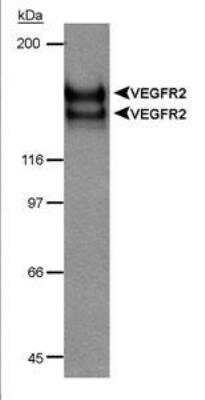 Western Blot: VEGFR2/KDR/Flk-1 Antibody [NB100-529]