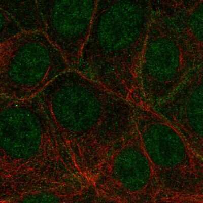 Immunocytochemistry/ Immunofluorescence: VEGFR3/Flt-4 Antibody [NBP2-68669]