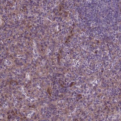 Immunocytochemistry/ Immunofluorescence: VEGFR3/Flt-4 Antibody [NBP2-68863]