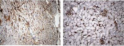 Immunohistochemistry-Paraffin: VEGFR3/Flt-4 Antibody (RM0003-5F63) - Azide and BSA Free [NB110-61018]