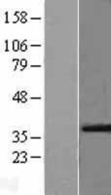 Western Blot: VEGF Overexpression Lysate [NBL1-17712]