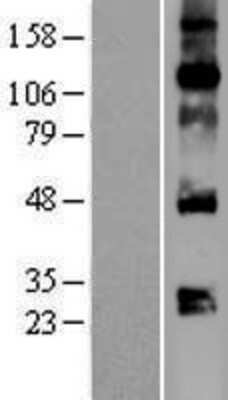 Western Blot: VEGF Overexpression Lysate [NBP2-09175]