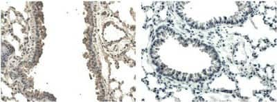 Immunohistochemistry-Paraffin: VEGF-B Antibody (RM0008-6E72) - Azide and BSA Free [NB110-61024]