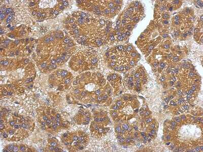 Immunohistochemistry-Paraffin: VEGF-C Antibody [NBP2-20853]