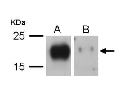 Western Blot: VEGF-C Antibody [NBP2-20853]