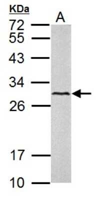 Western Blot: VEGF-C Antibody [NBP2-20853]