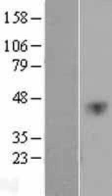 Western Blot: VEGF-C Overexpression Lysate [NBP2-04293]